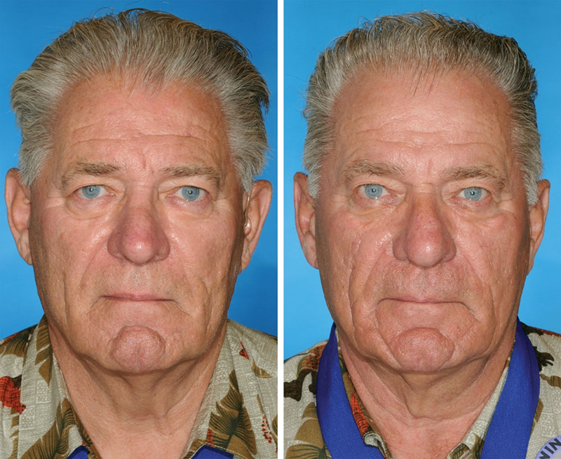 Illustration for article titled Guess which of these identical twins is the smoker
